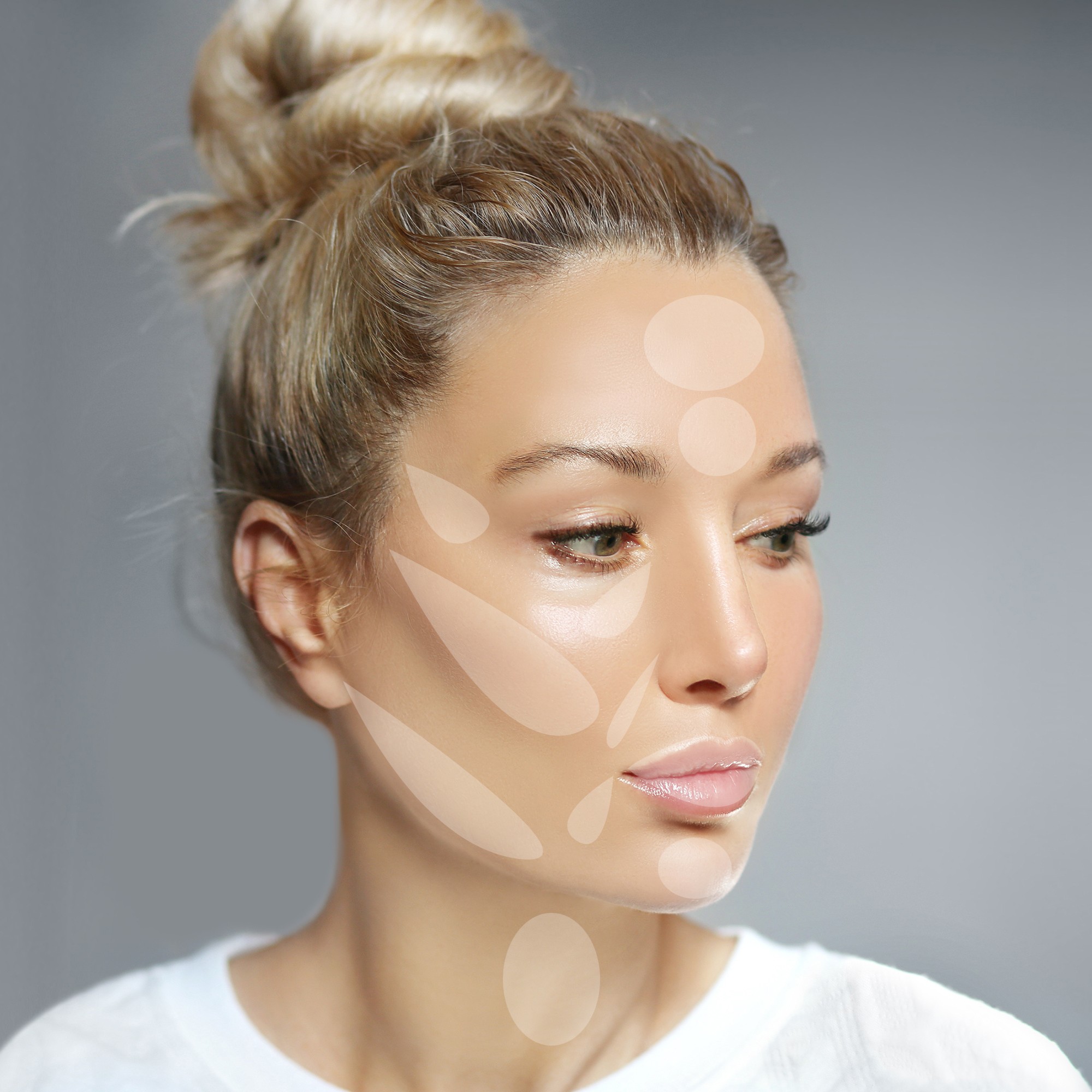 dermalfillers large 1